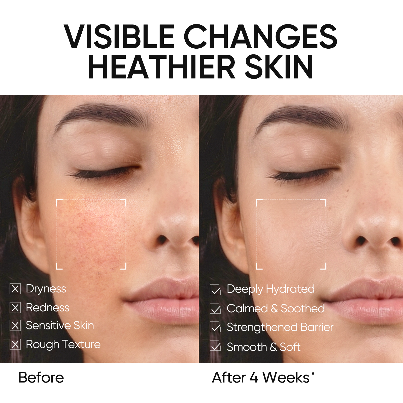 5X Ceramide Barrier Repair Moisture Gel