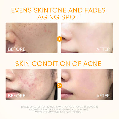10% Vitamin C Glow Serum Hellt dunkle Flecken auf und gleicht den Hautton aus