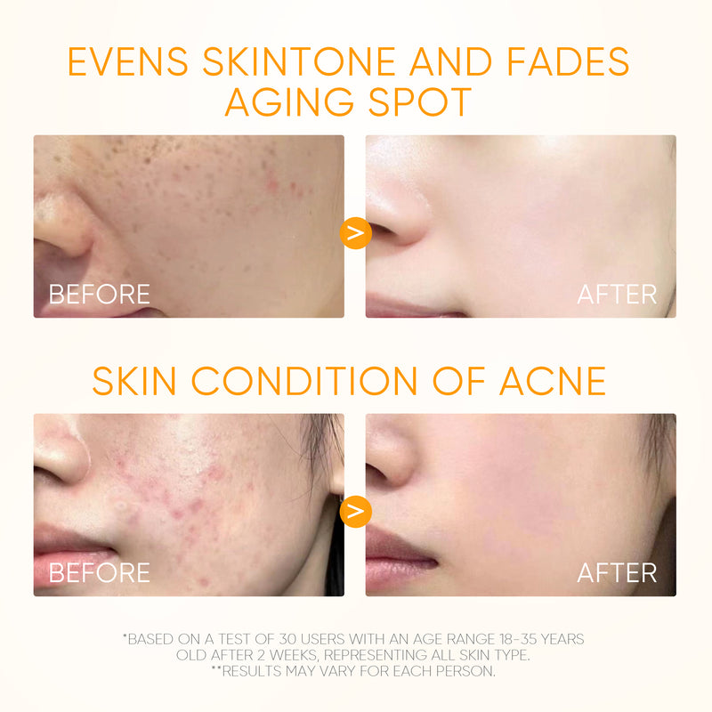 10% Vitamin C Glow Serum Hellt dunkle Flecken auf und gleicht den Hautton aus