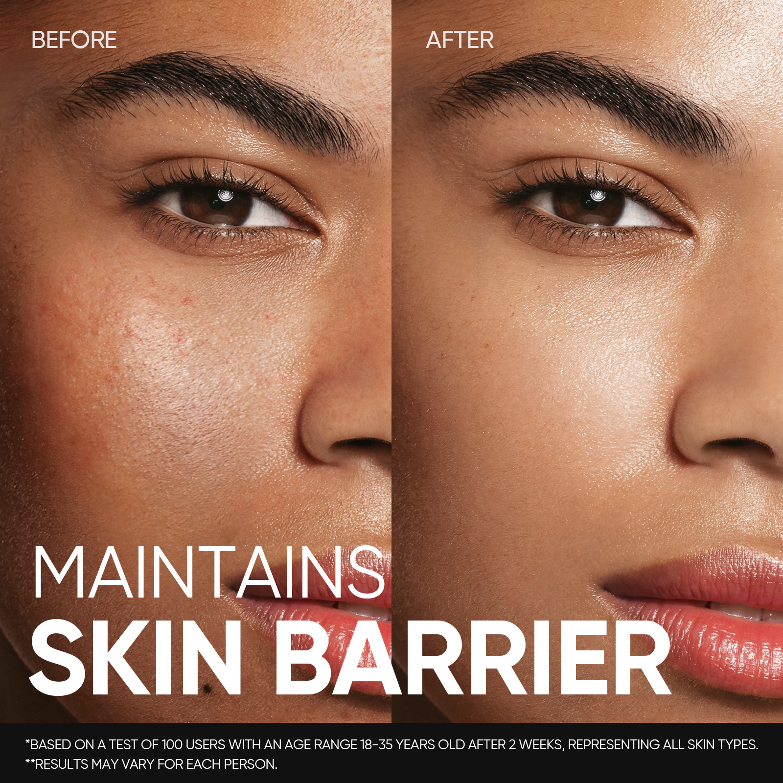 5X Ceramid Beruhigender Toner