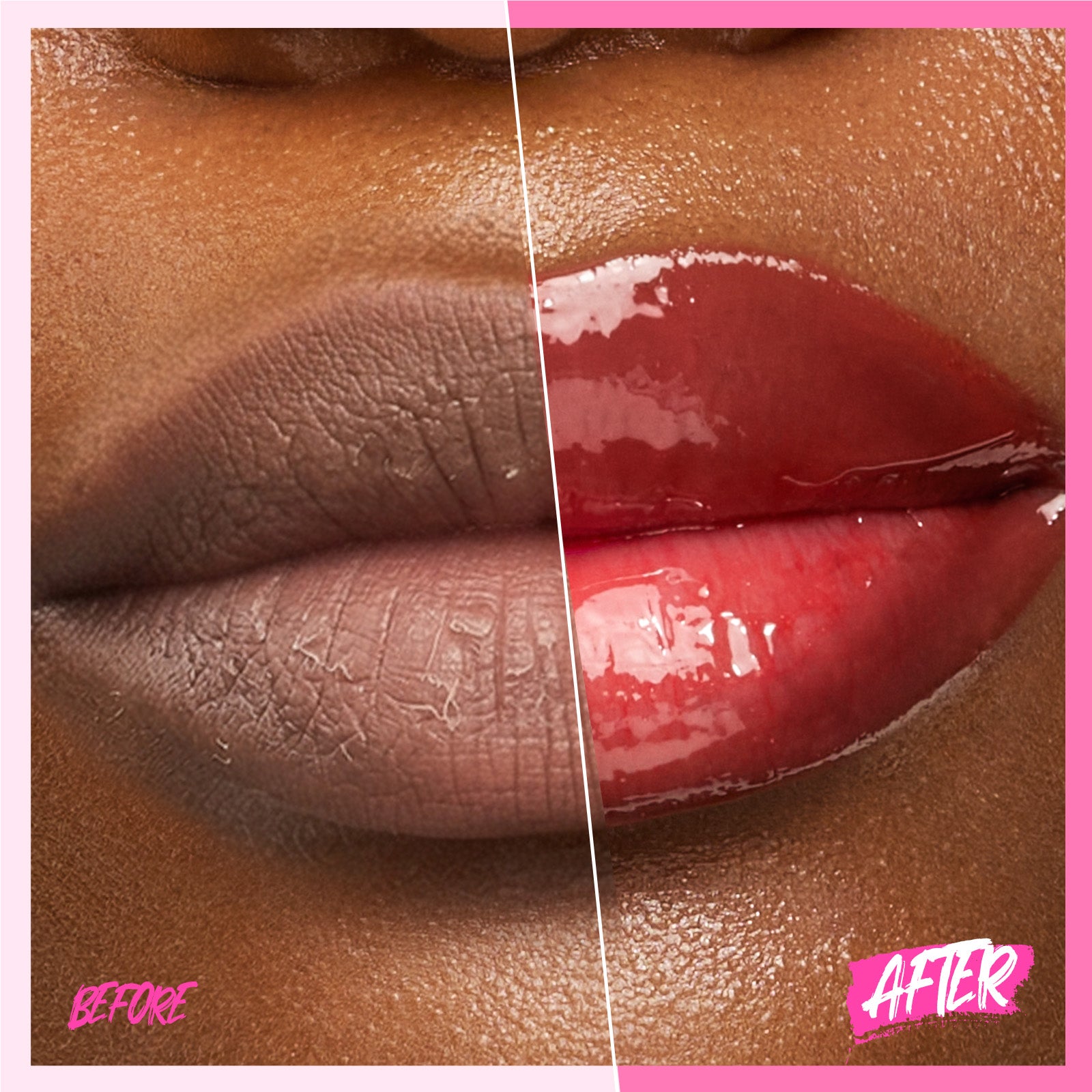 Peptid Aufhellendes Lippen-Serum