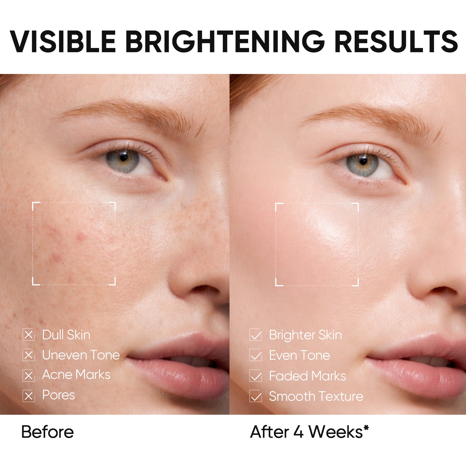 Niacinamide Aufhellungsset