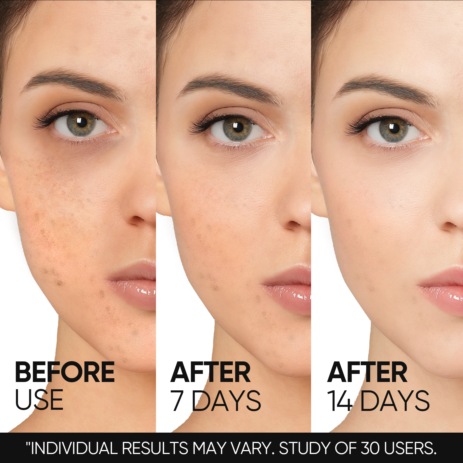 10% Niacinamid Aufhellendes Serum