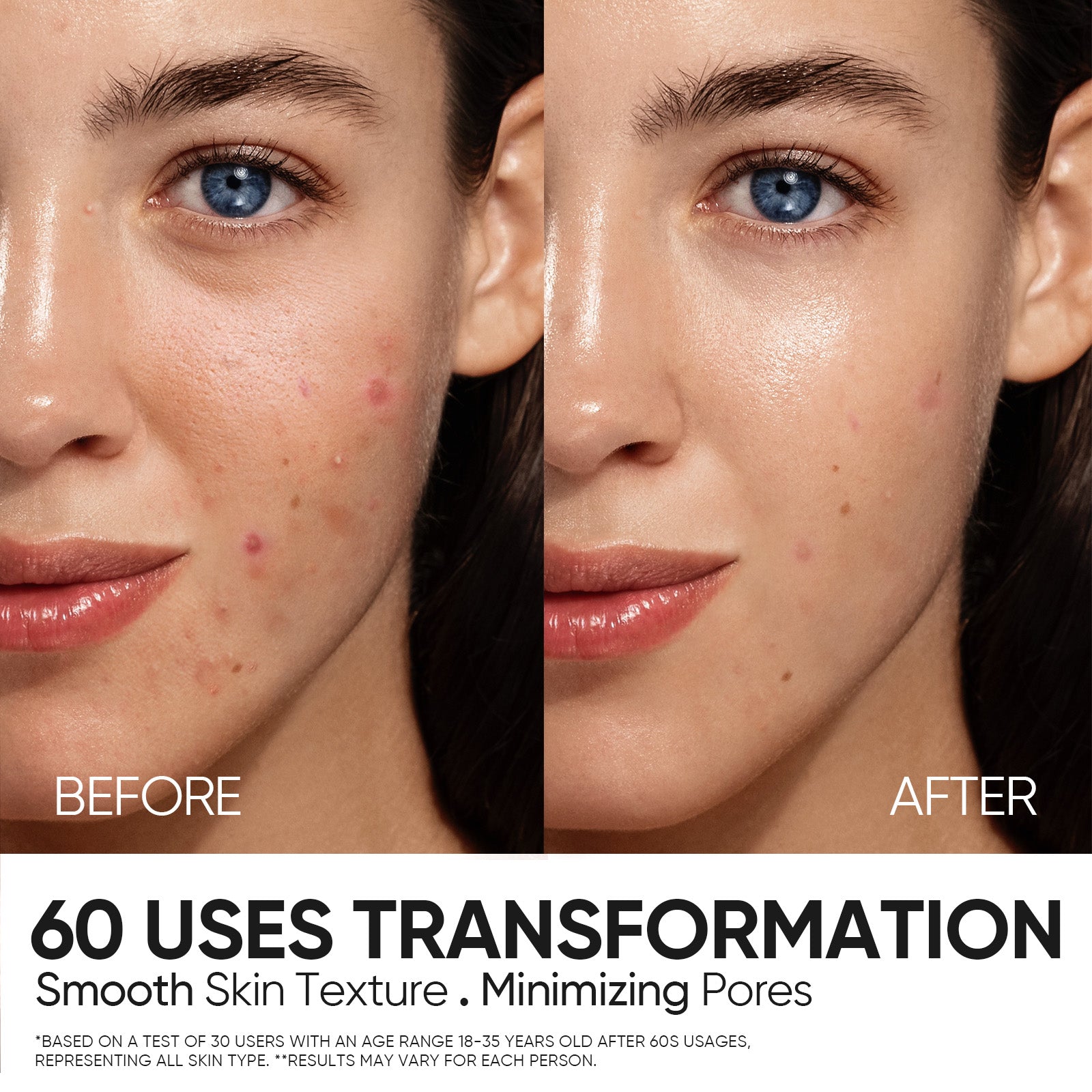 12% AHA BHA PHA LHA Peeling-Lösung