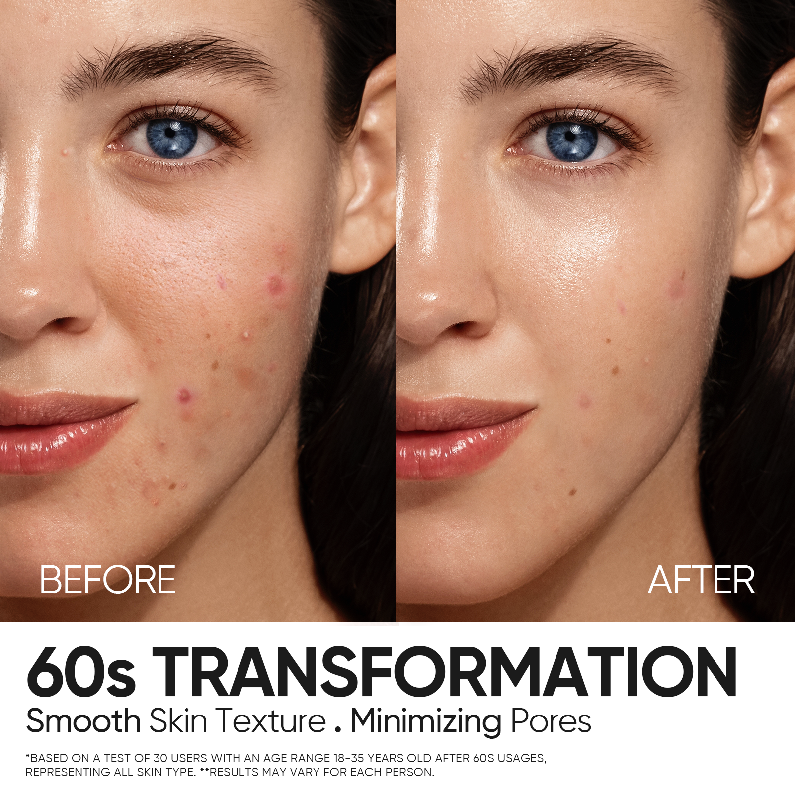 12% AHA BHA PHA LHA Peeling-Lösung