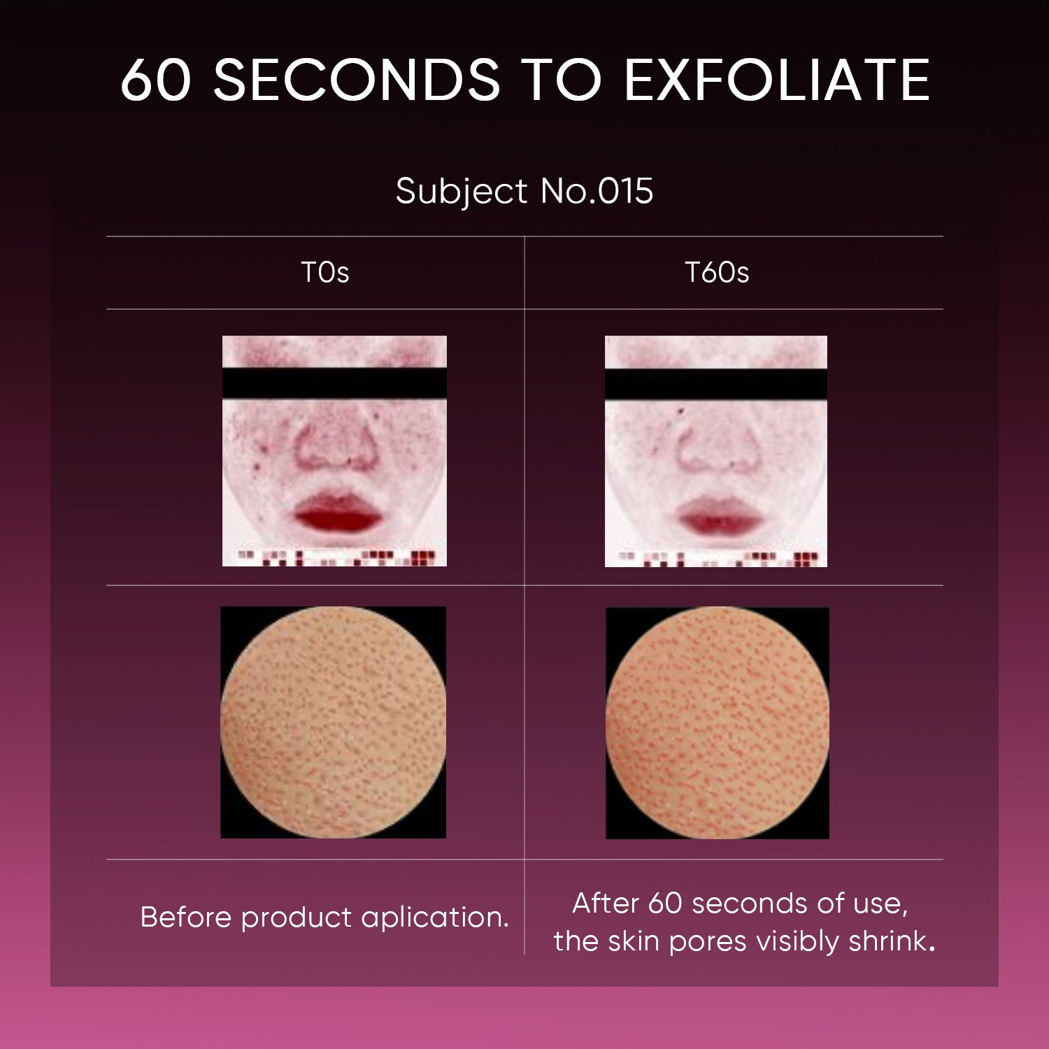 12% AHA BHA PHA LHA Peeling-Lösung