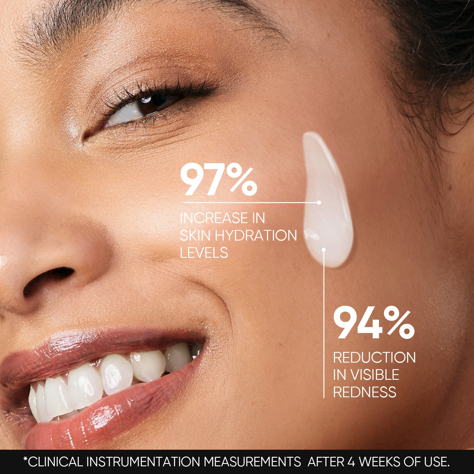 5X Ceramid Barriere Serum