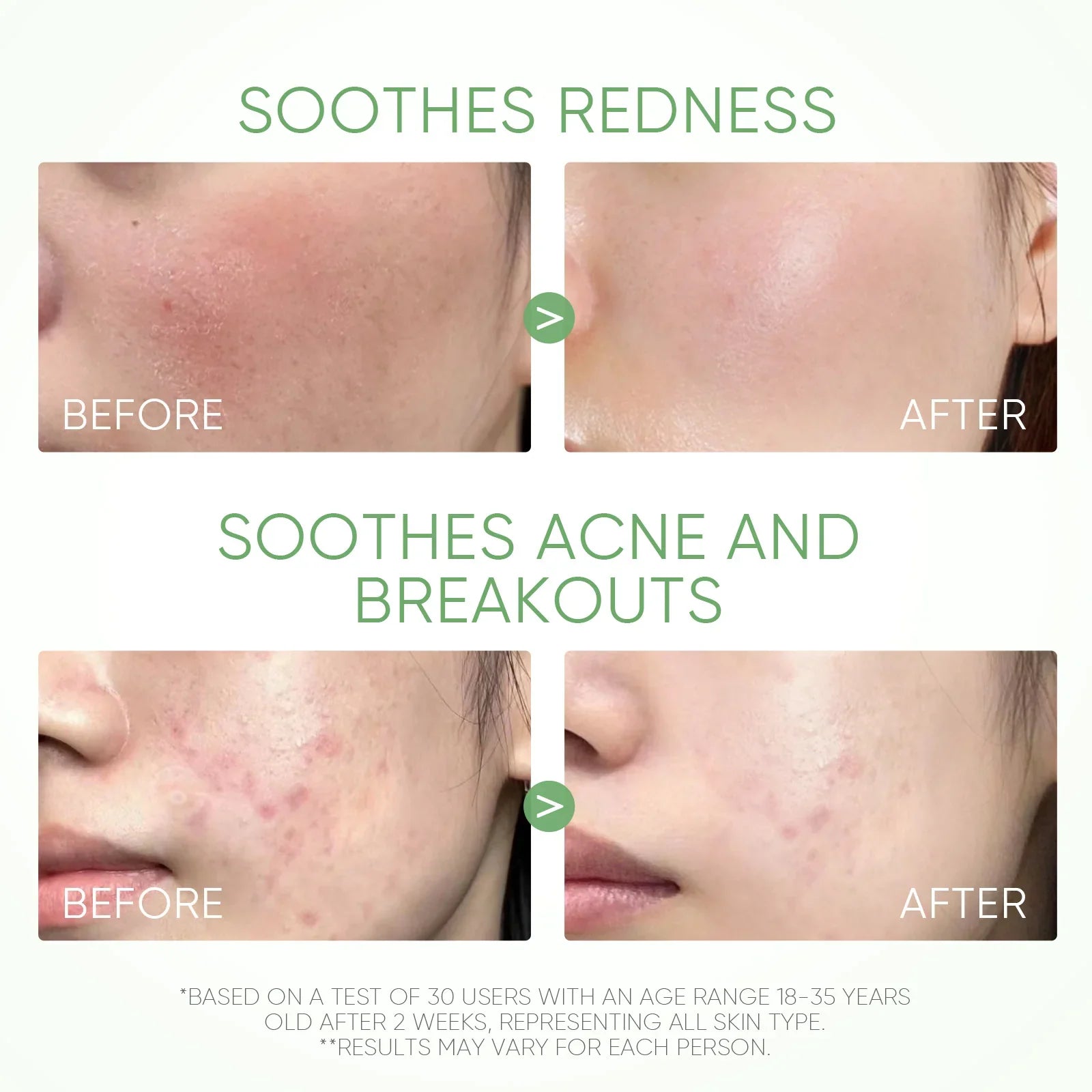 Beifuß Akne Tonerde-Stick