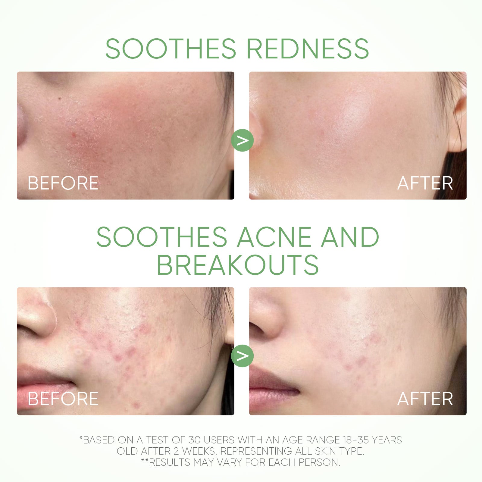 Beifuß Akne Tonerde-Stick