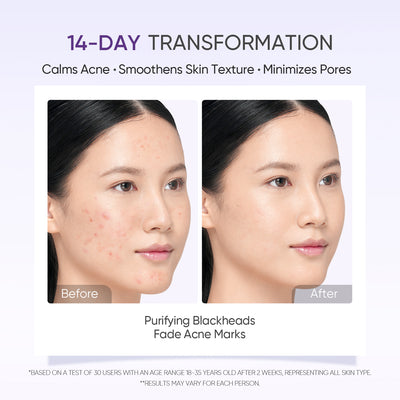 Milchsäure-Peeling-Serum Glatte & strahlende Haut