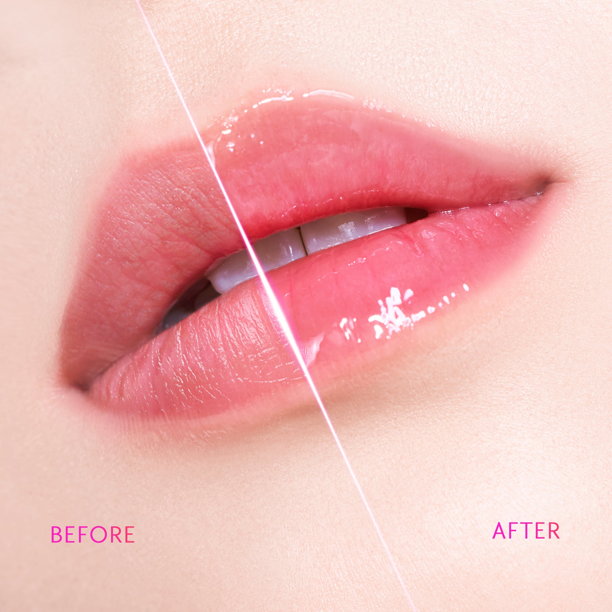 Peptid Aufhellendes Lippen-Serum