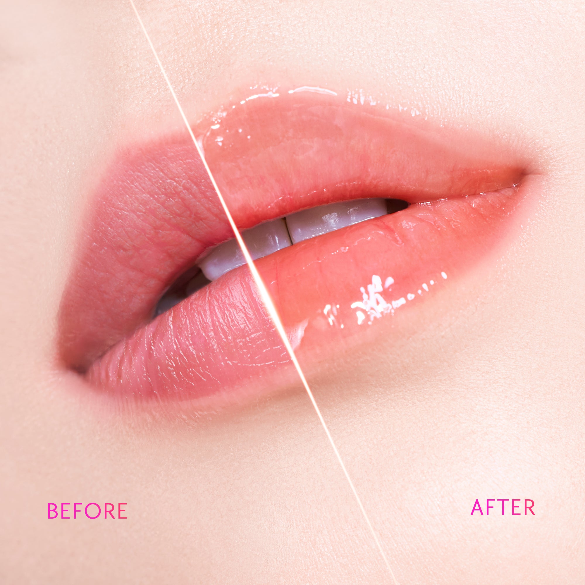 Peptid Aufhellendes Lippen-Serum