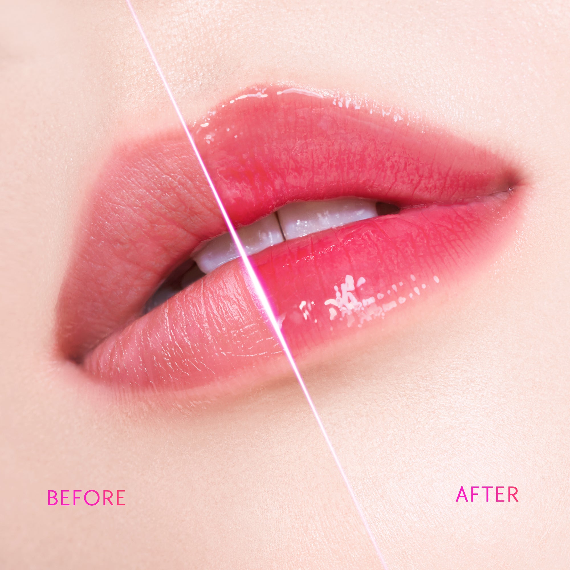 Peptid Aufhellendes Lippen-Serum