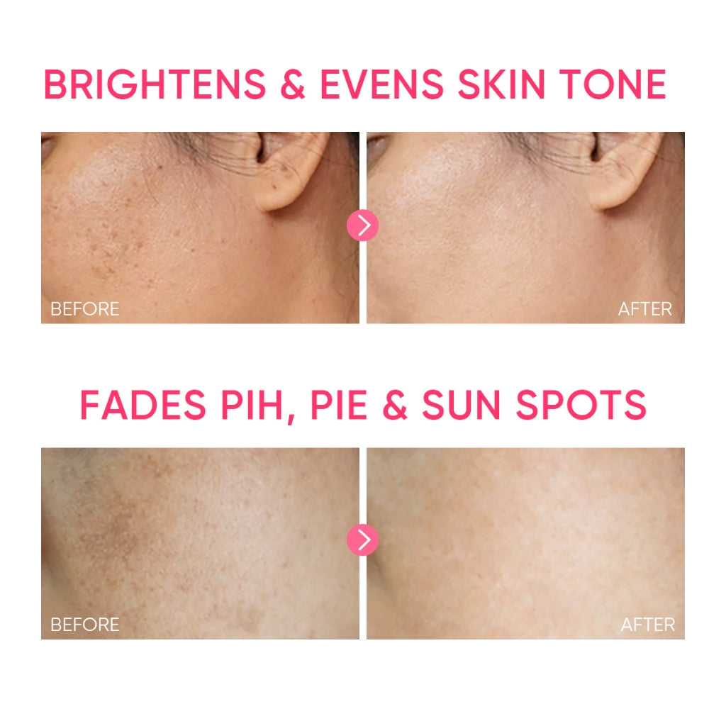 MSH Niacinamid Aufhellendes Feuchtigkeits-Gel