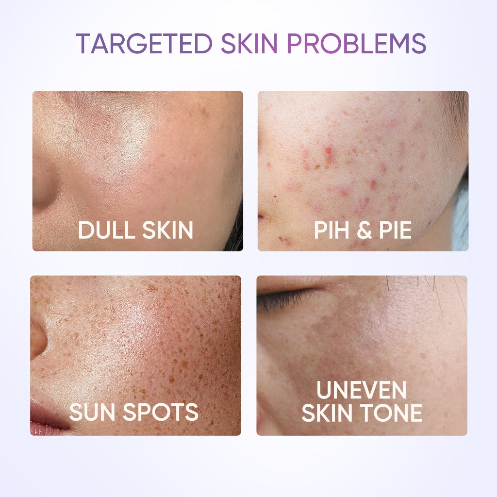 SymWhite 377 Feuchtigkeitsgel gegen dunkle Flecken