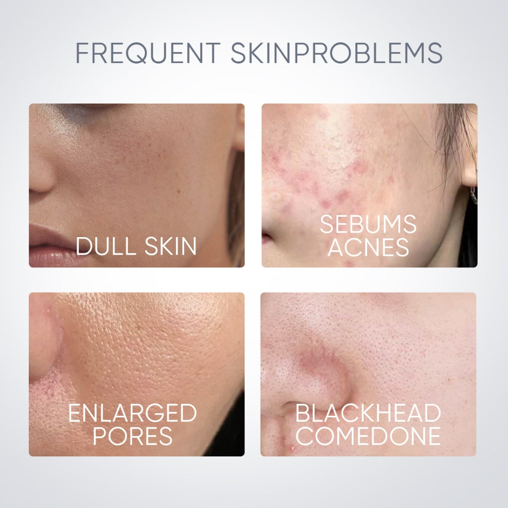 Alaska Vulkan Poren Tonerde-Stick