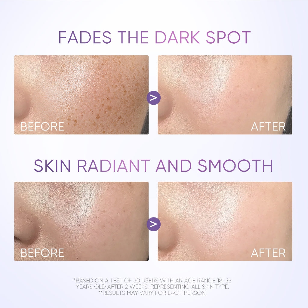 Symwhite 377 Fleckenreduzierendes Serum