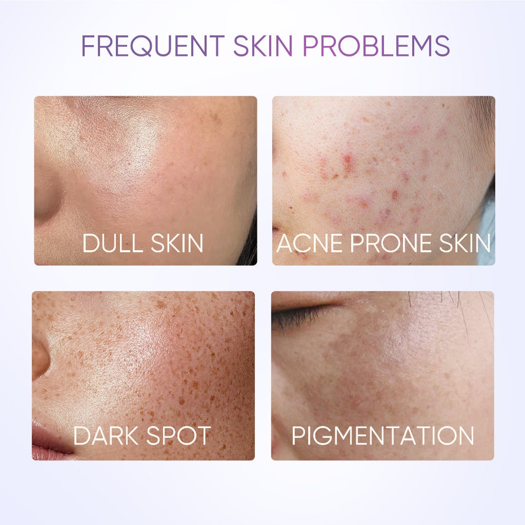 Symwhite 377 Fleckenreduzierendes Serum