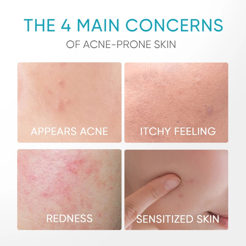 5% Panthenol Akne-Beruhigendes Wasser-Gel