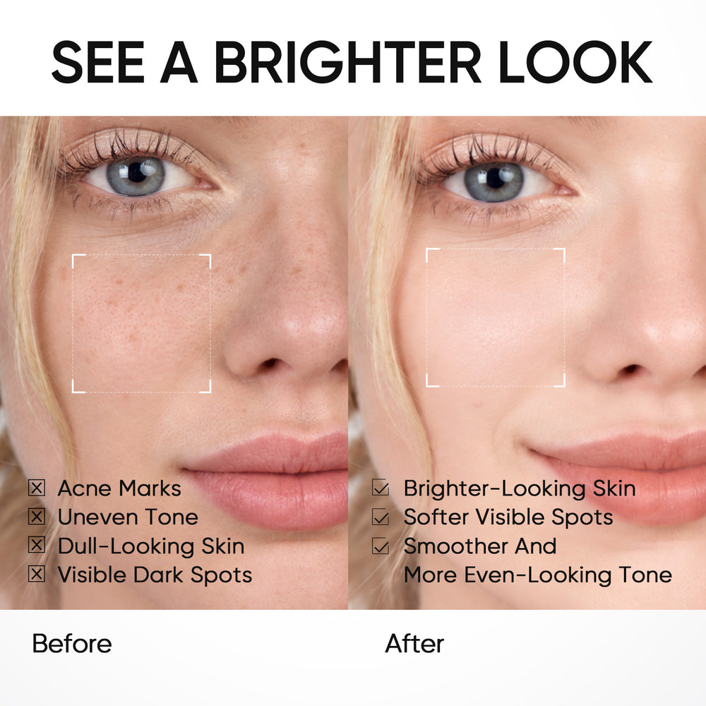 10% Niacinamid Aufhellendes Serum