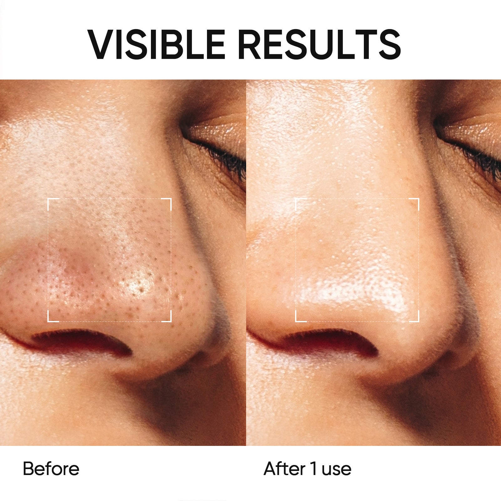 Alaska Vulkan Poren Tonerde-Stick