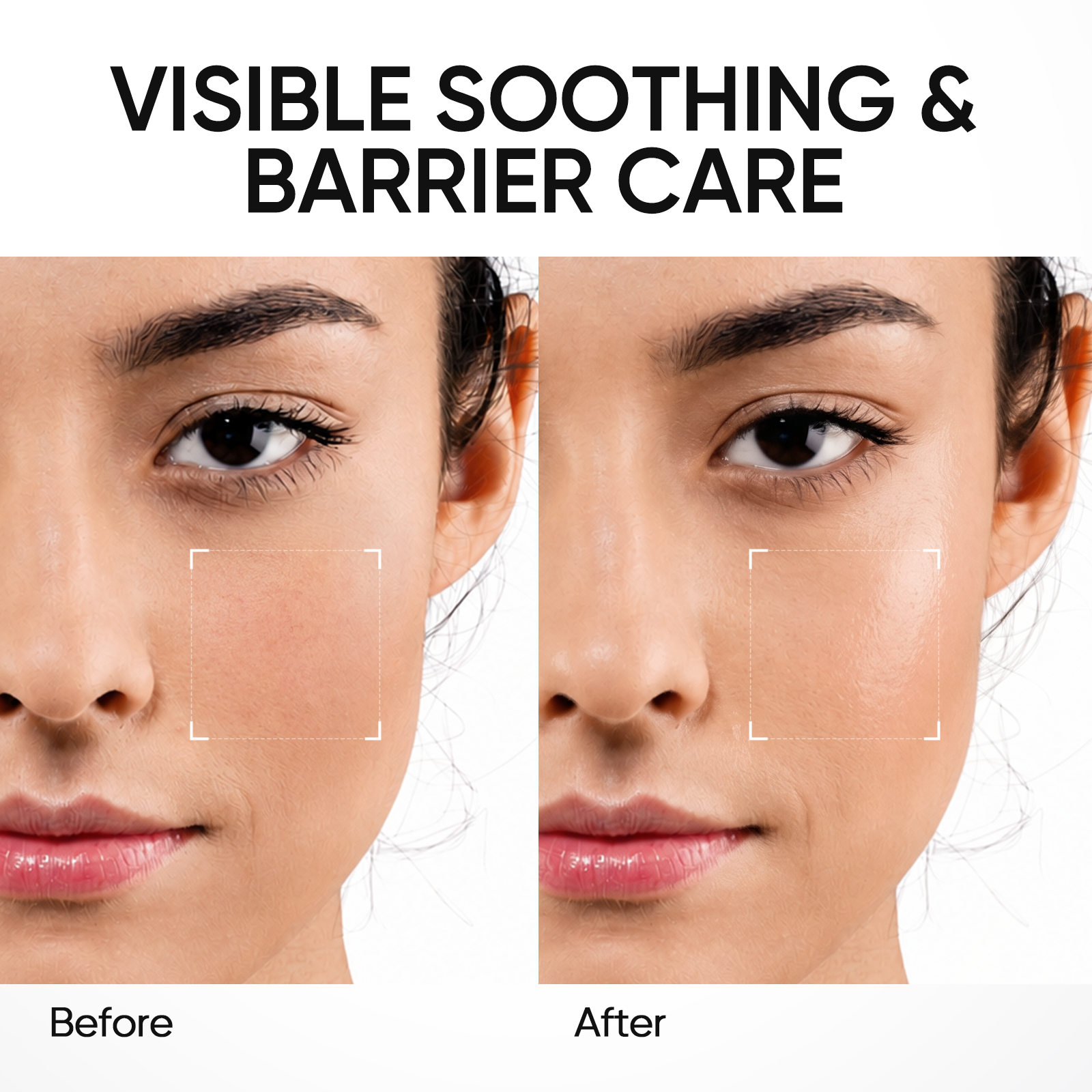 5X Ceramide Skin Barrier Repair Serum