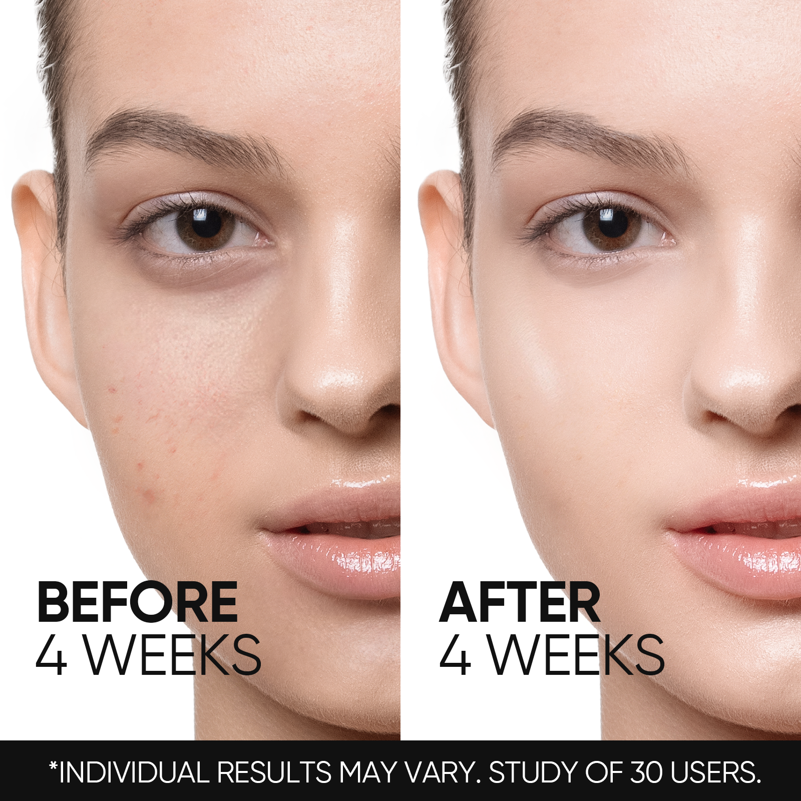 Retinol Skin Renewal Moisturizer