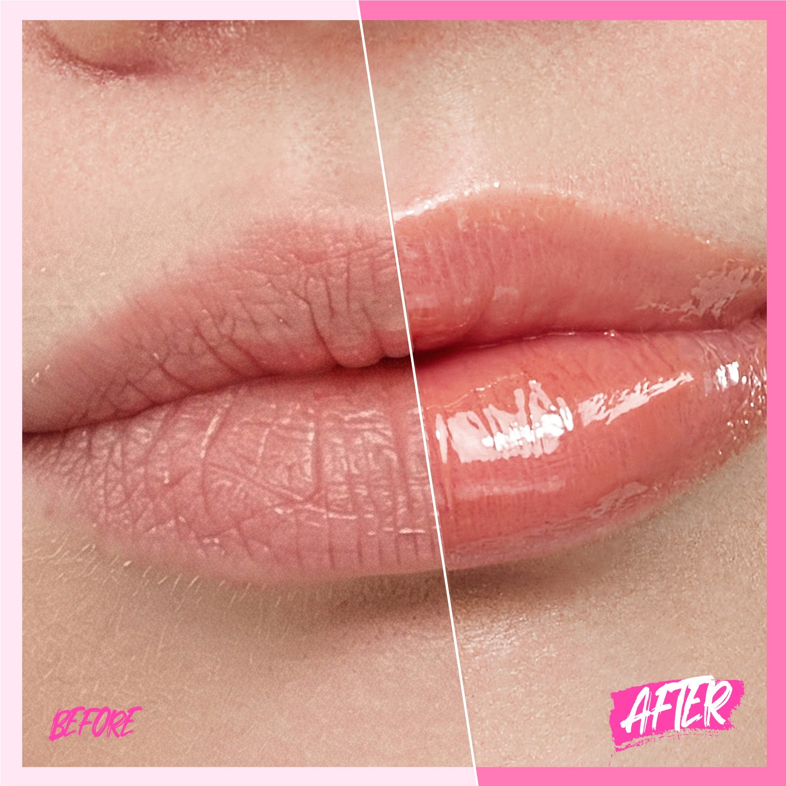 Peptid Aufhellendes Lippen-Serum