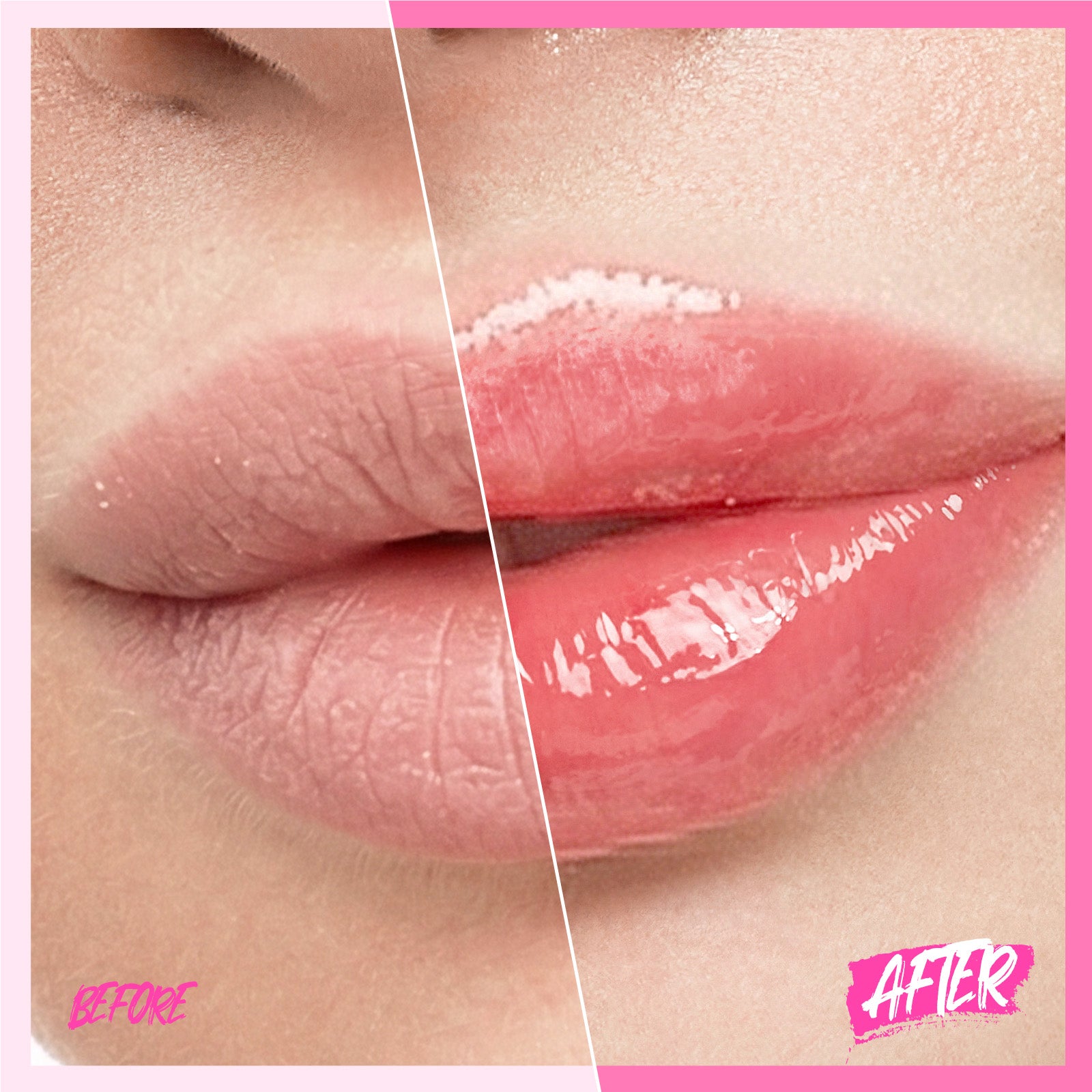 Peptid Aufhellendes Lippen-Serum