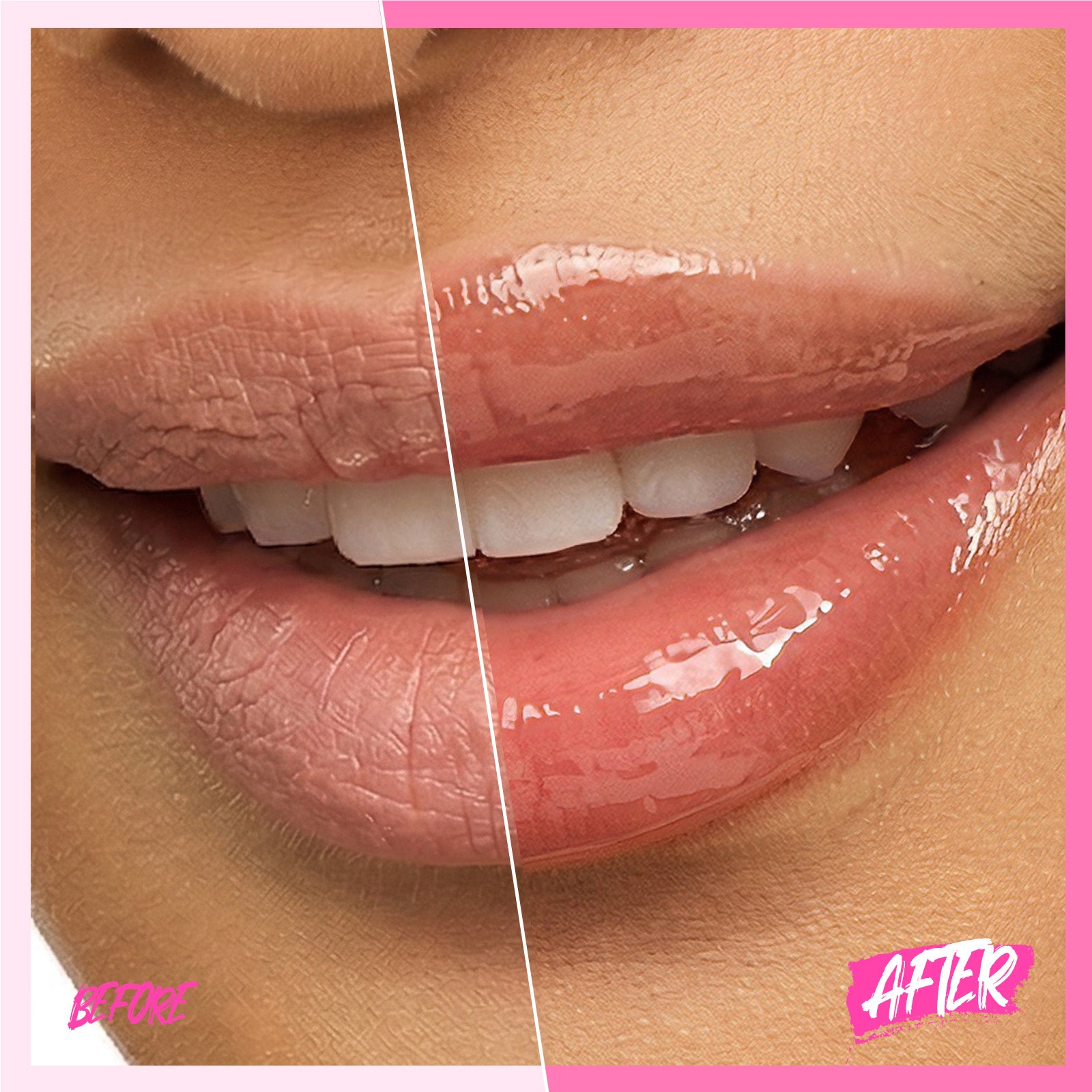 Peptid Aufhellendes Lippen-Serum
