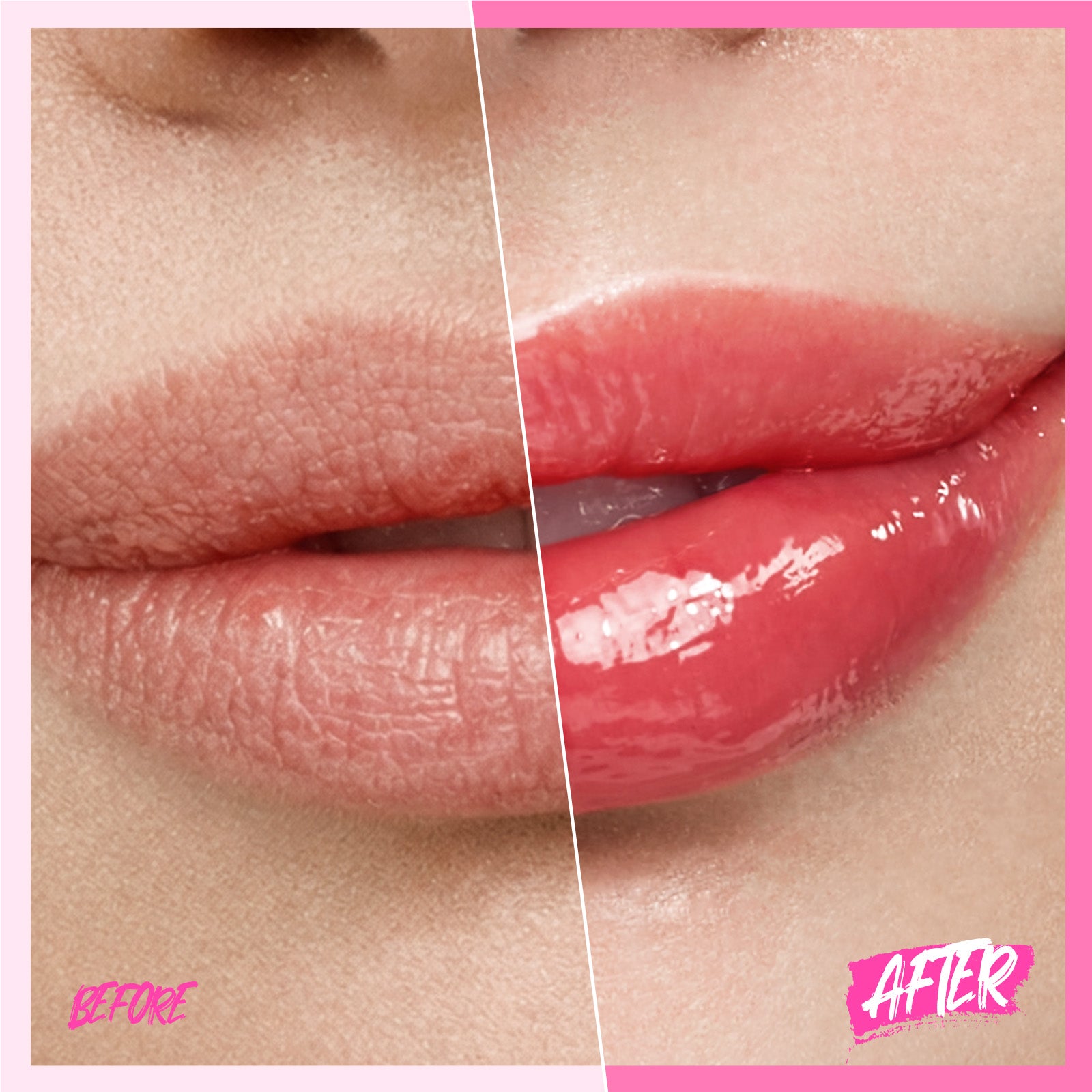 Peptid Aufhellendes Lippen-Serum