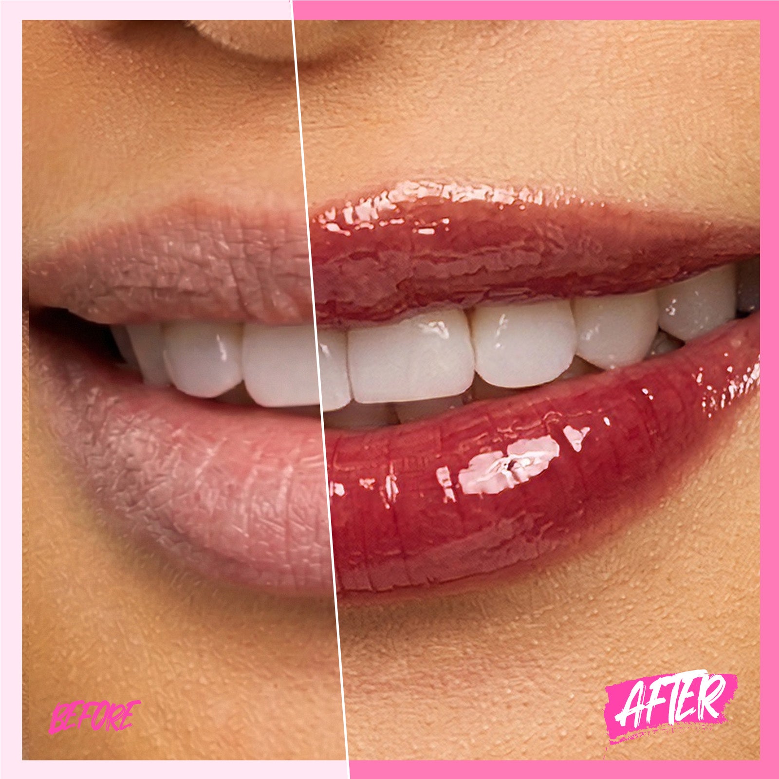Peptid Aufhellendes Lippen-Serum