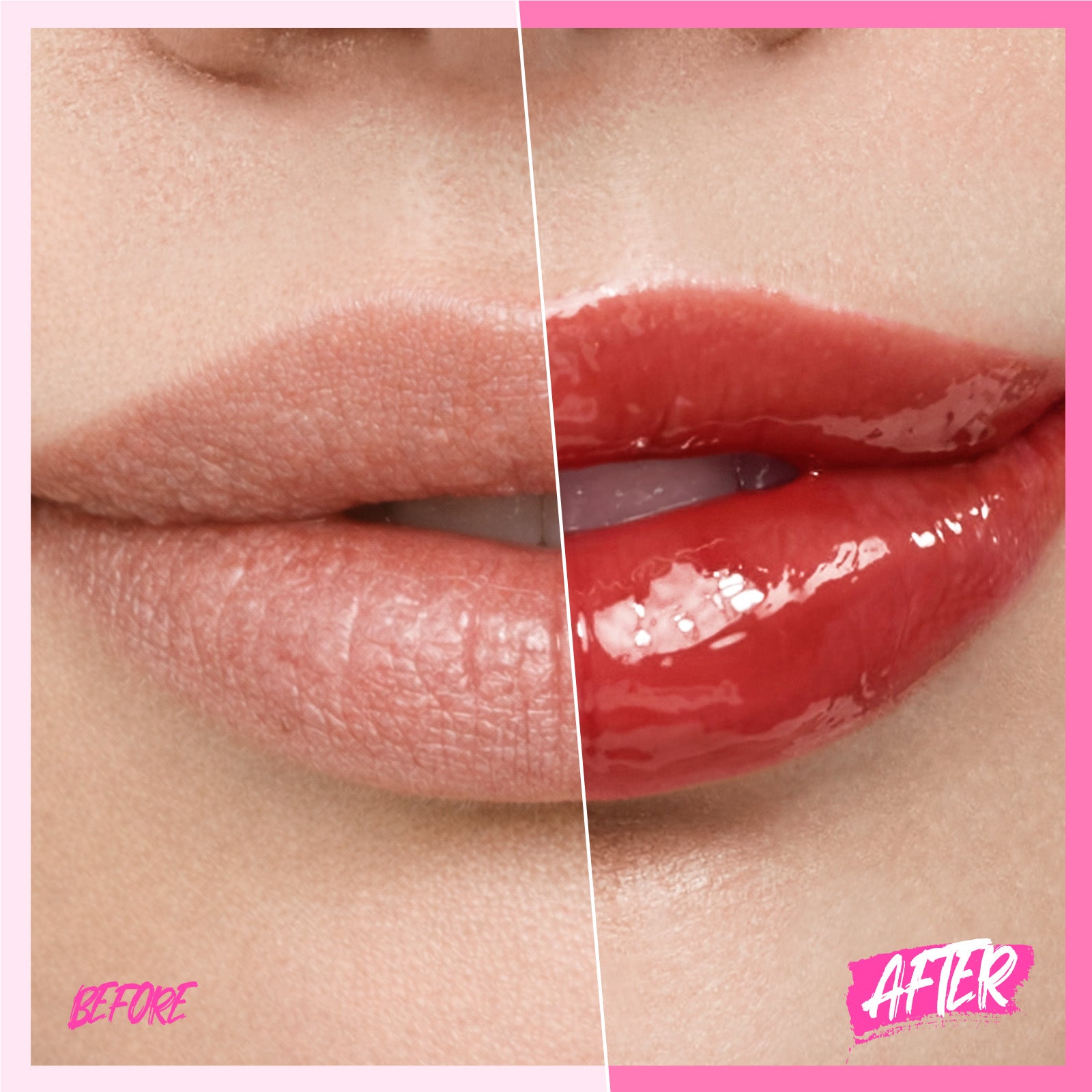 Peptid Aufhellendes Lippen-Serum