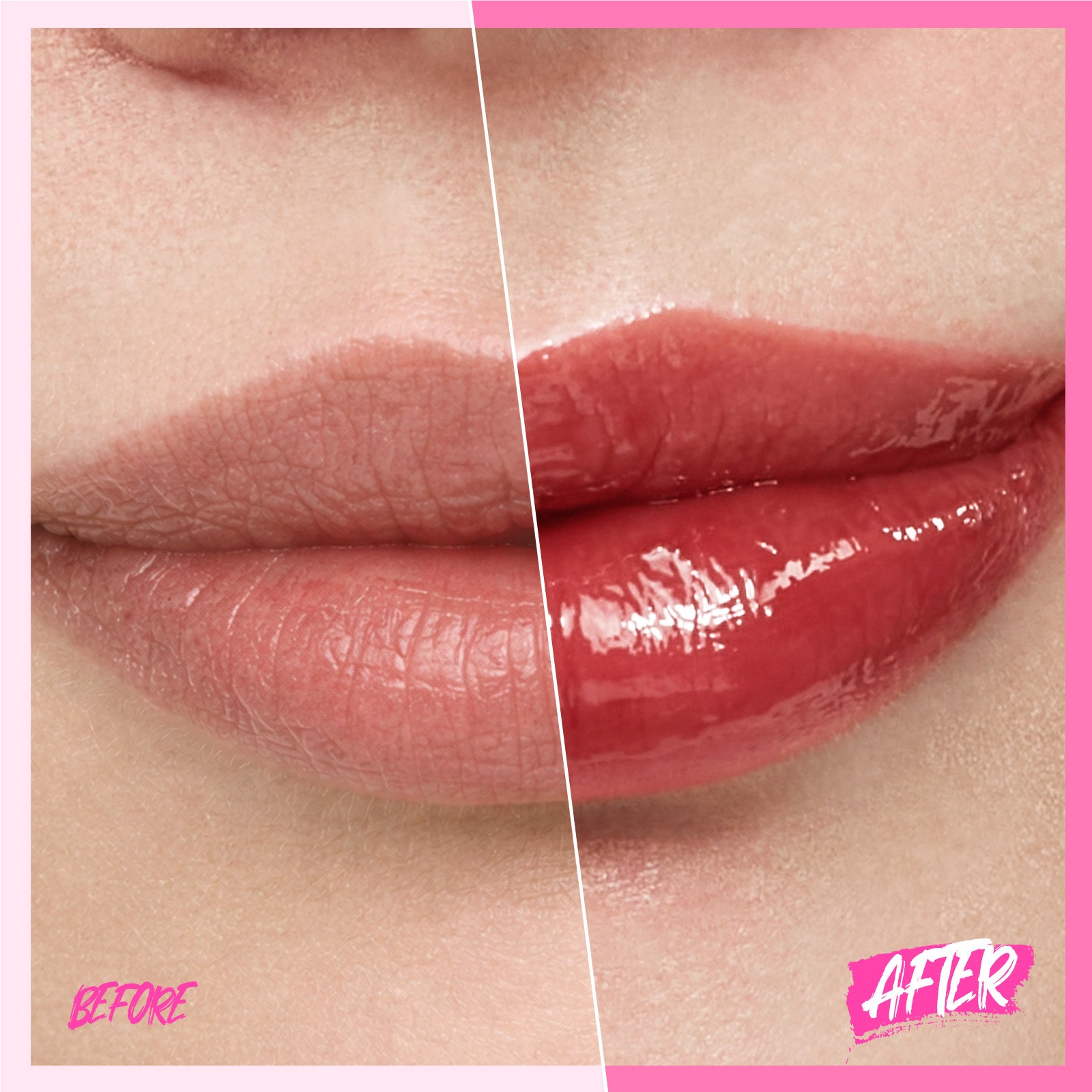 Peptid Aufhellendes Lippen-Serum