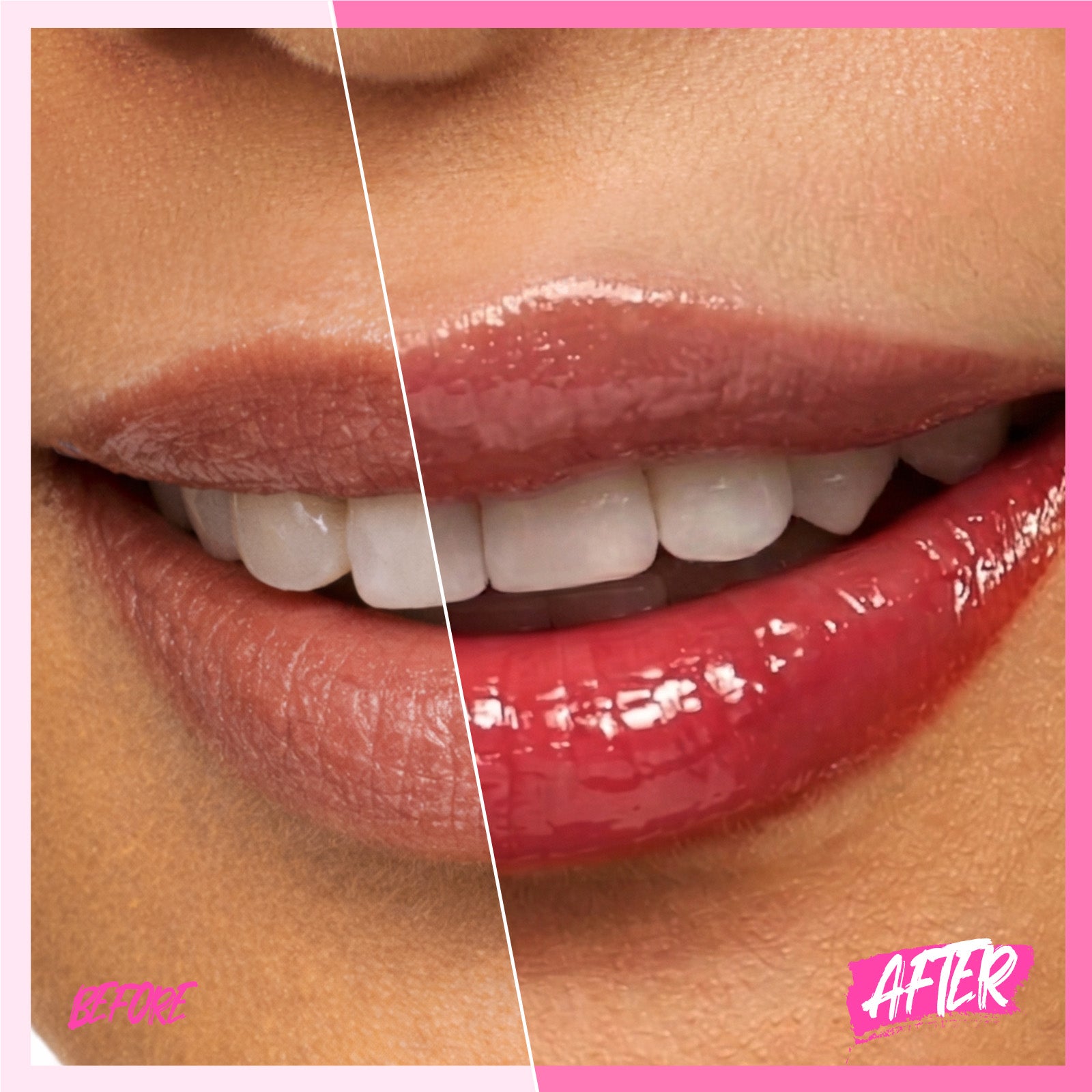 Peptid Aufhellendes Lippen-Serum