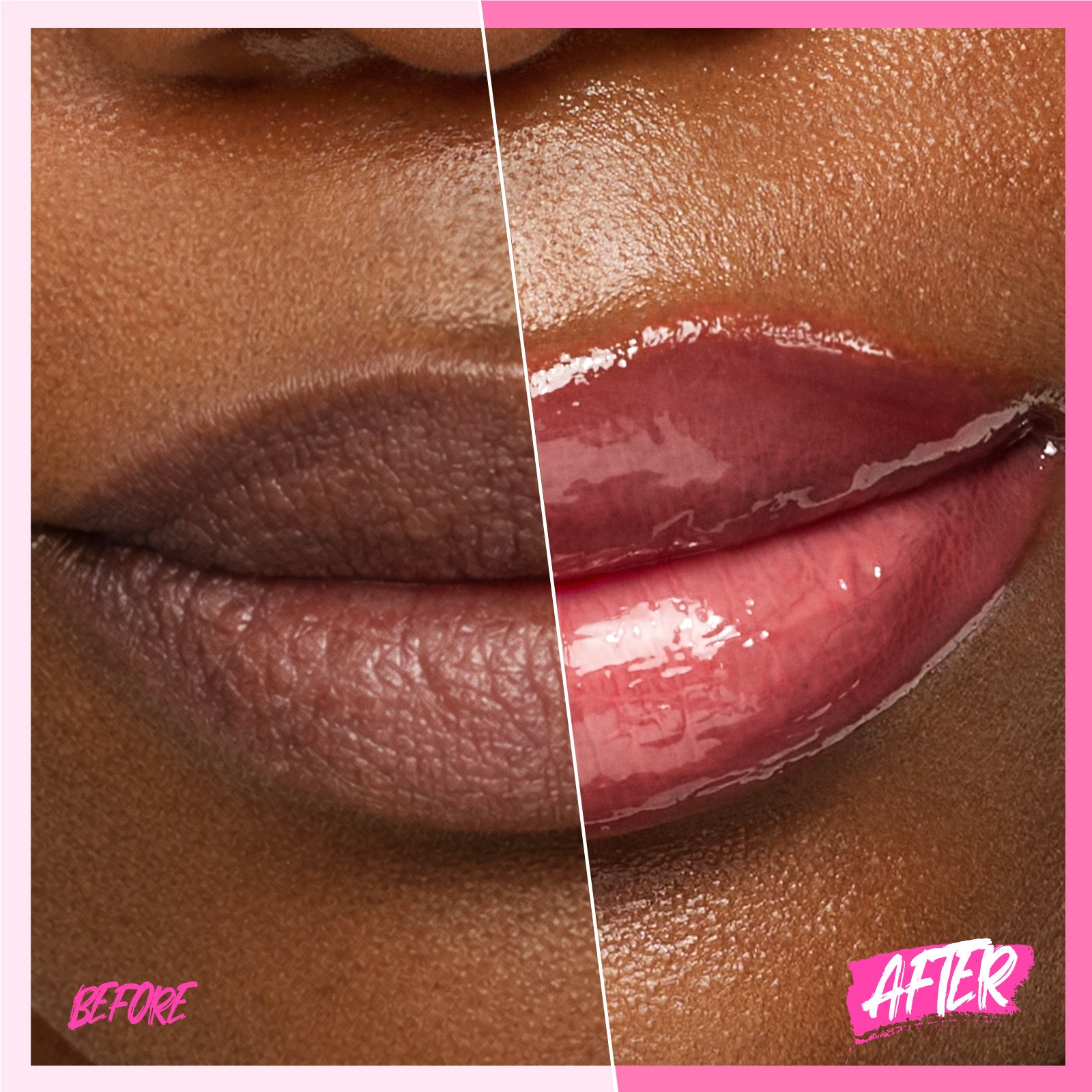 Peptid Aufhellendes Lippen-Serum
