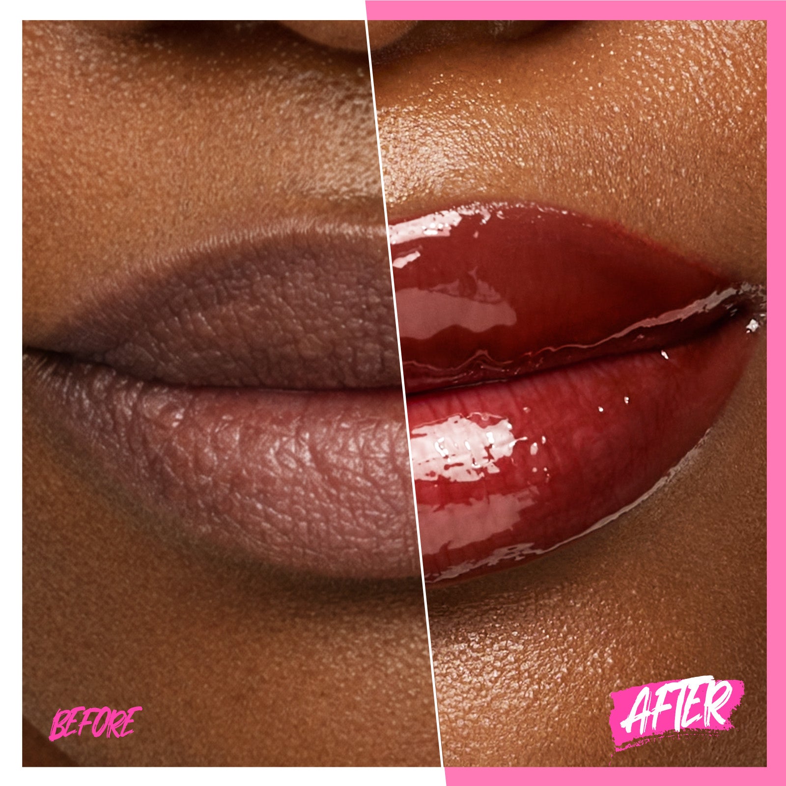 Peptid Aufhellendes Lippen-Serum