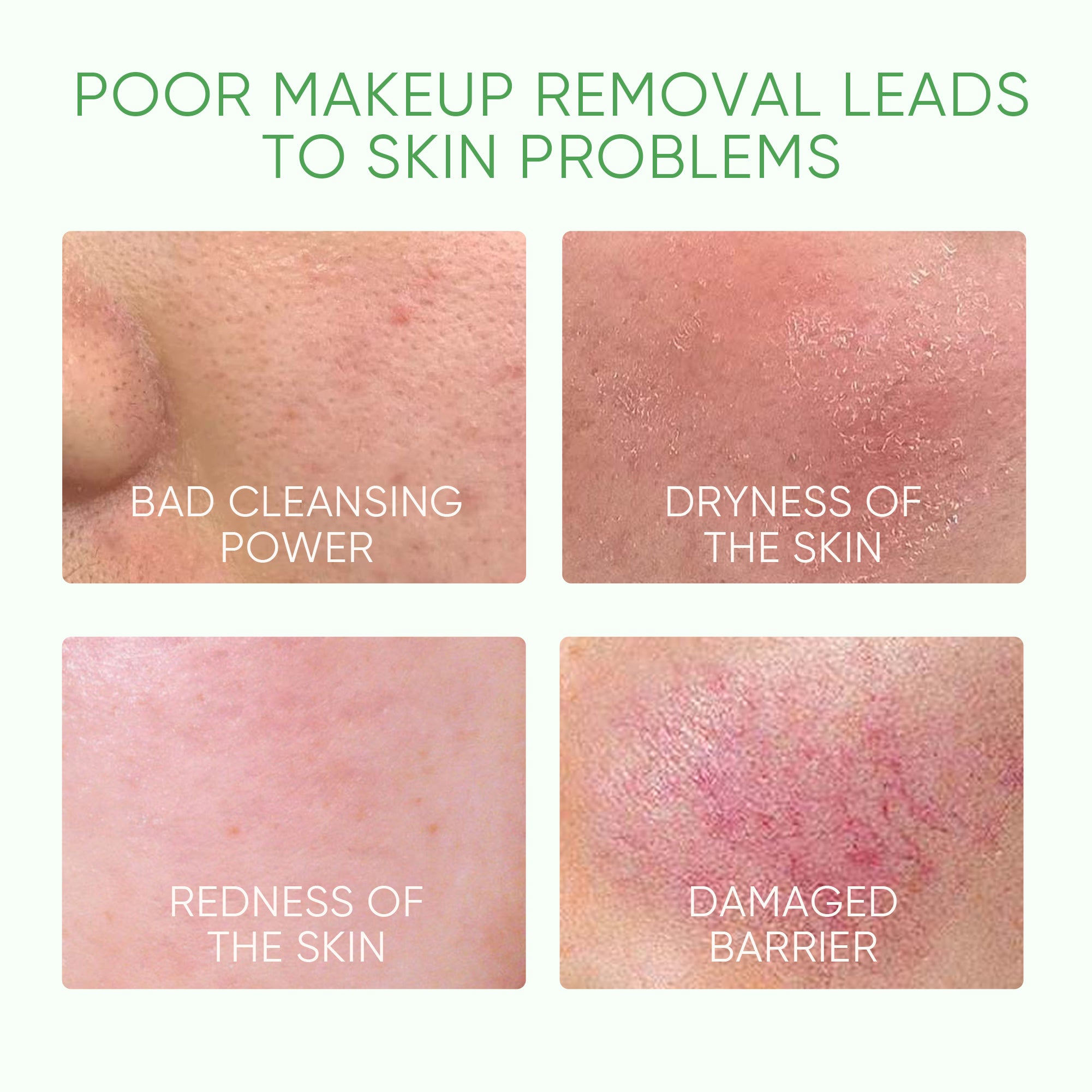 Beifuß Klärender Mizellen Make-up-Entferner mit Ceramid & Centella