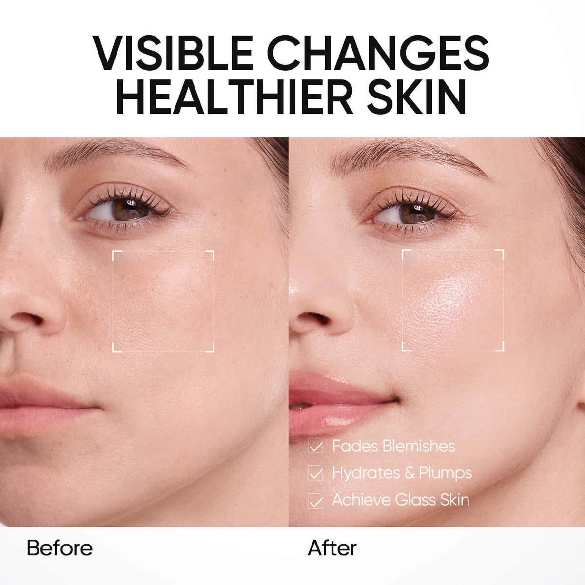 PDRN Bright & Smooth Feuchtigkeits-Gel-Creme