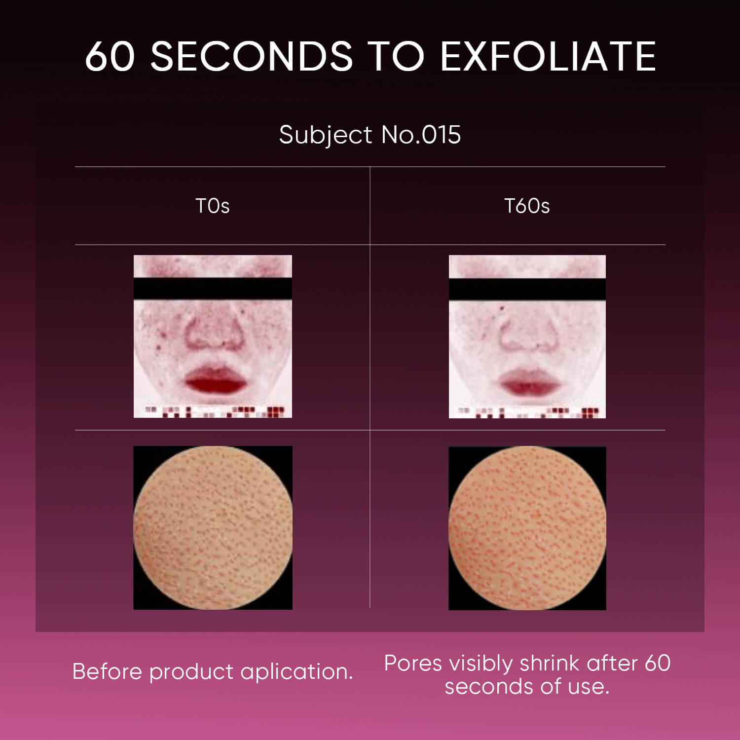 12% AHA BHA PHA LHA Peeling-Lösung