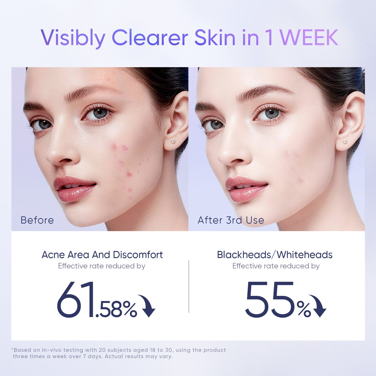 AHA BHA PHA Peeling-Pads